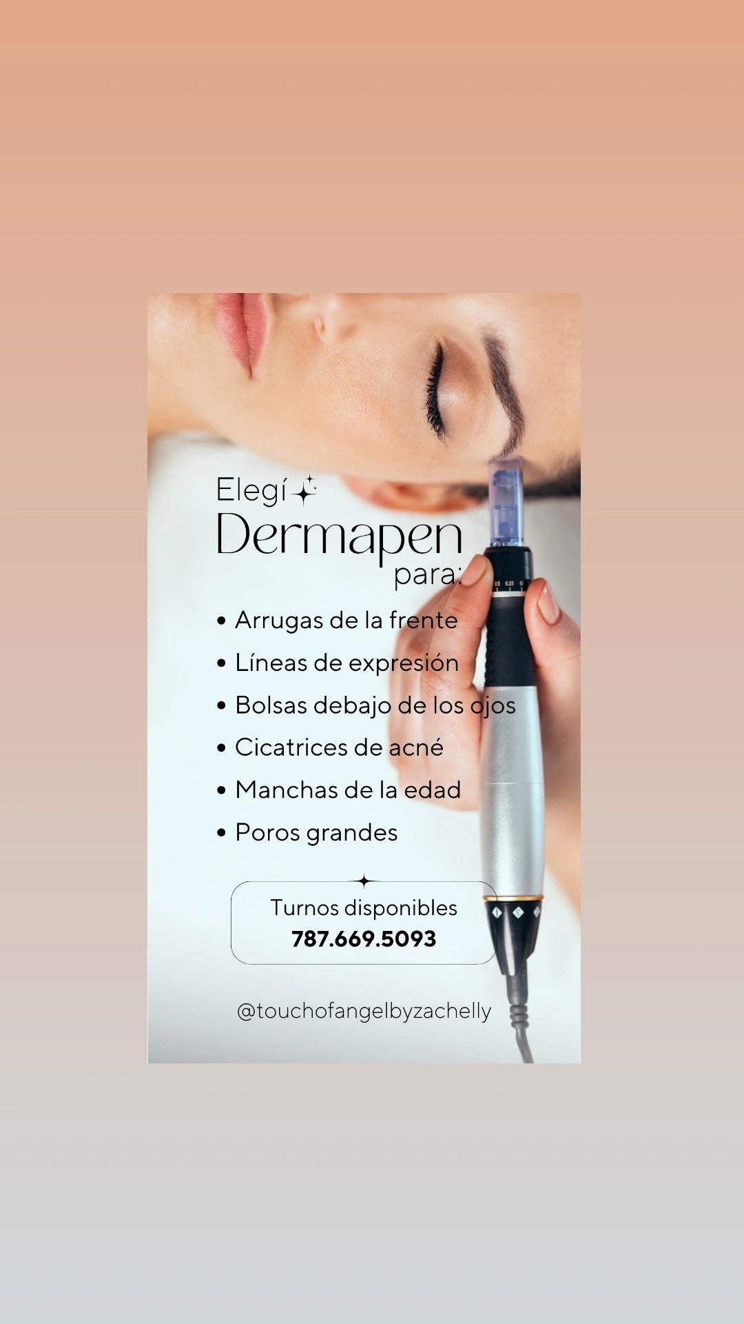 Dermapen (microagujas)