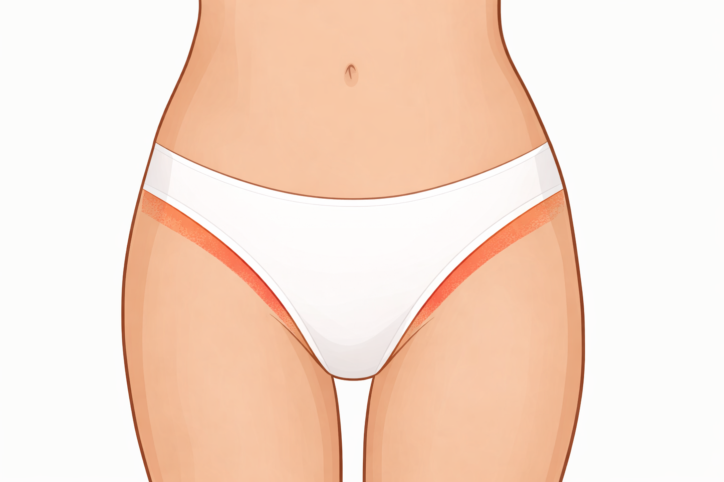 Depilación Láser Diodo – Bikini Line
Paquete de 8 Sesiones